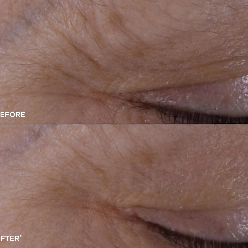 DOUBLE SERUM® Eye Brightening + Depuffing Anti-Aging Concentrate